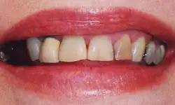 Before & After Gallery Image