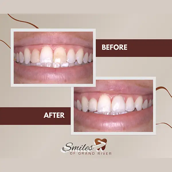 Before and After Image