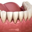 Tooth pain
