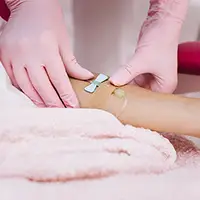 General Anesthesia