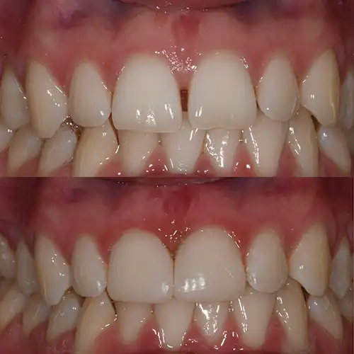 Before & After Gallery image
