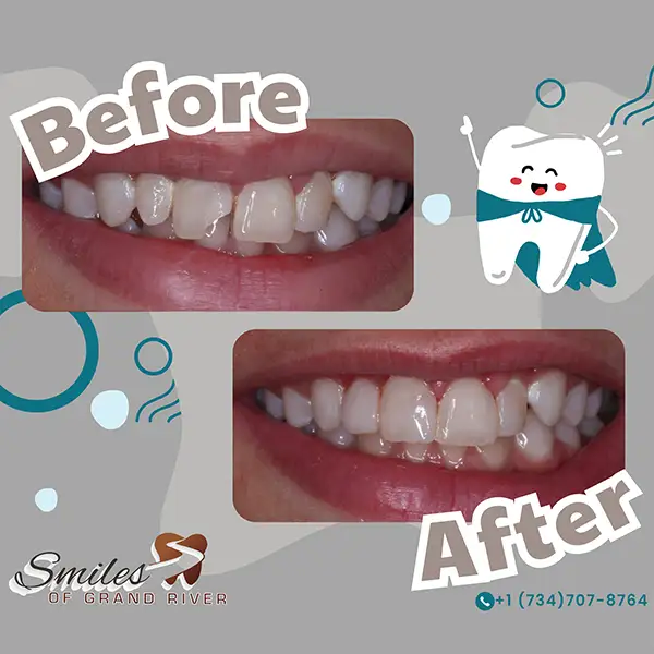 Before and After Image