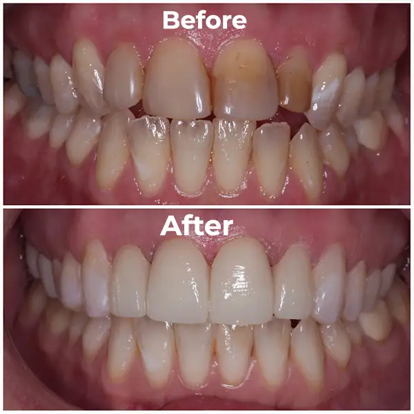 Before and After Image