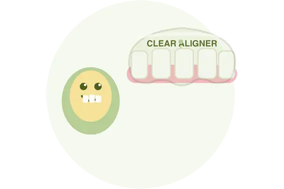 Clear aligners