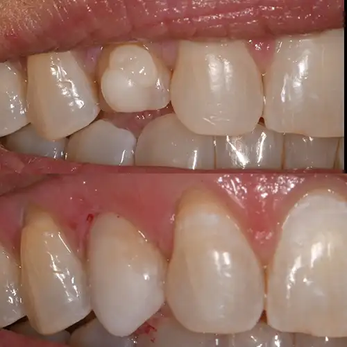 Before & After Gallery image