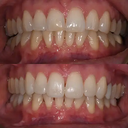 Before & After Gallery image