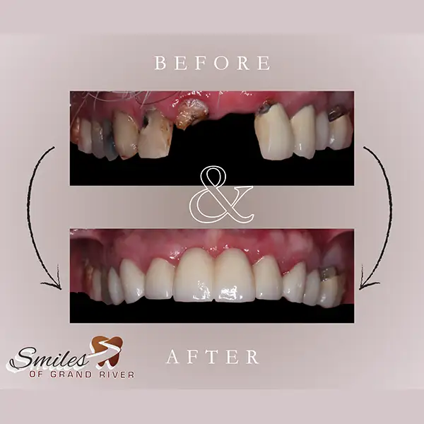 Before and After Image
