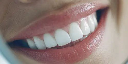 Cosmetic treatment