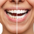 Tooth pain