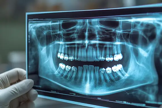 AI-assisted X-rays