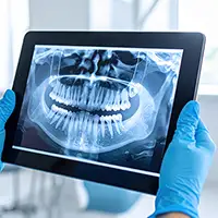 Early Orthodontic Screenings