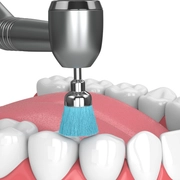 Pediatric Dental Cleaning