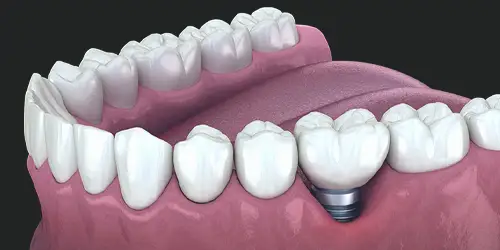 Advanced oral surgery