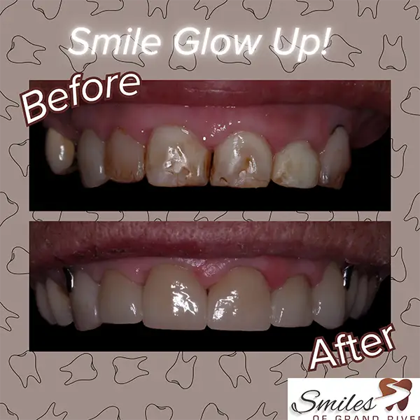 Before and After Image