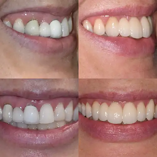 Before & After Gallery image