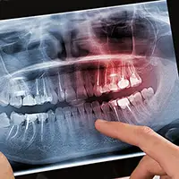 Digital X-Rays
