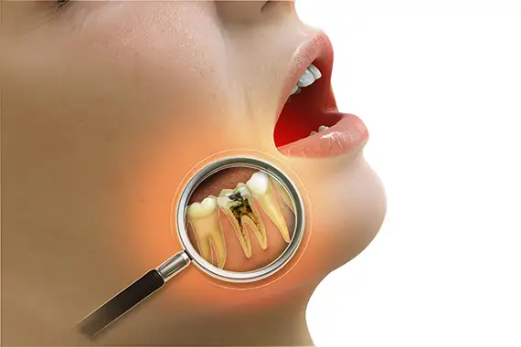 Pulp Therapy for Children