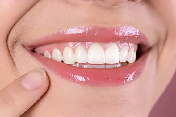 Gum Contouring