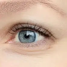 Close-up of a cosmetic dental bonding procedure on a patient's teeth.