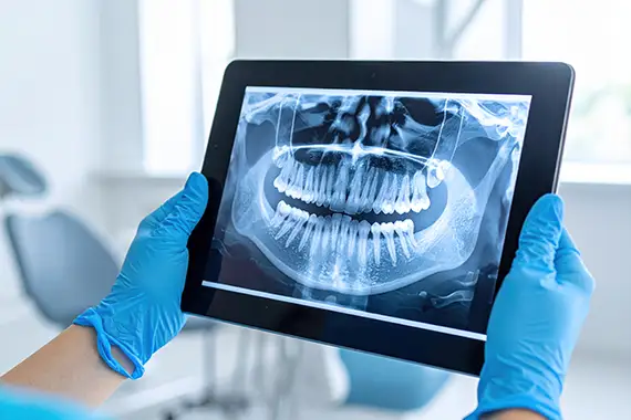 Orthodontic Screenings