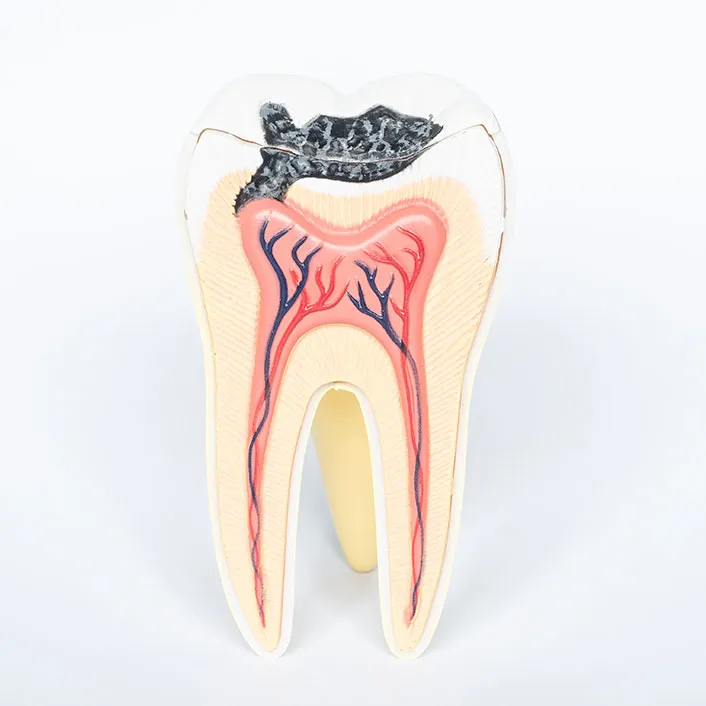 Cavity Detection System