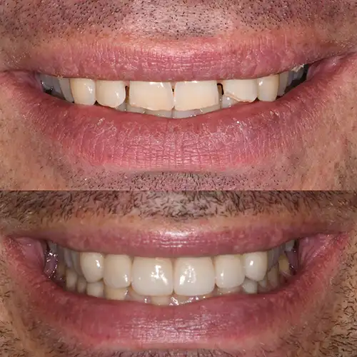Before & After Gallery image