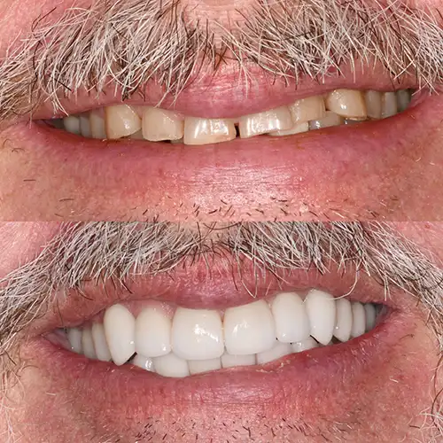 Before & After Gallery image