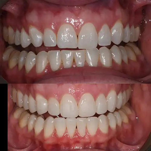 Before & After Gallery image