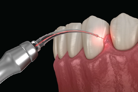 Dental 3D imaging equipment showcasing advanced imaging technology.