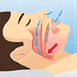 Sleep Apnea