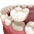 Restorative Dentistry