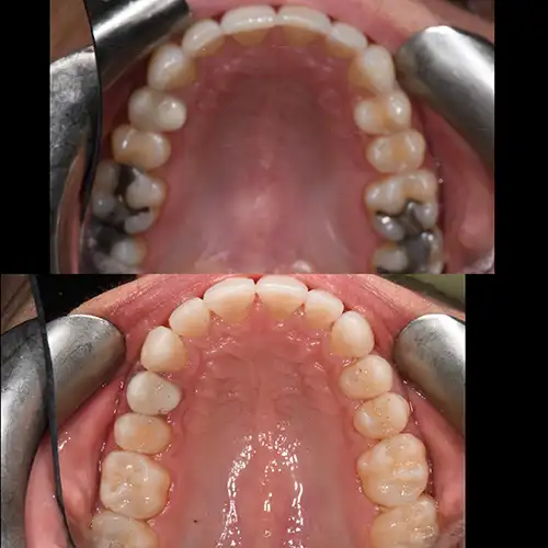 Before & After Gallery image