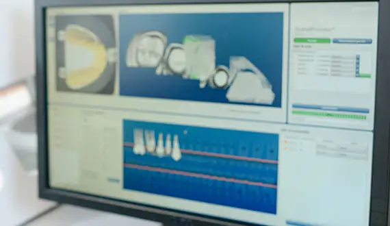 3D Imaging