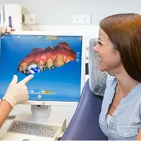 CEREC same-day crowns