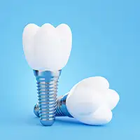 Implants