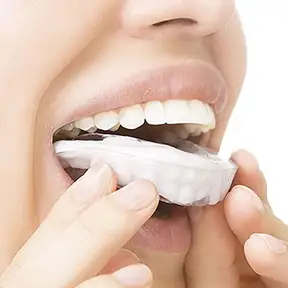 Custom dental night guard protecting teeth from nighttime grinding.