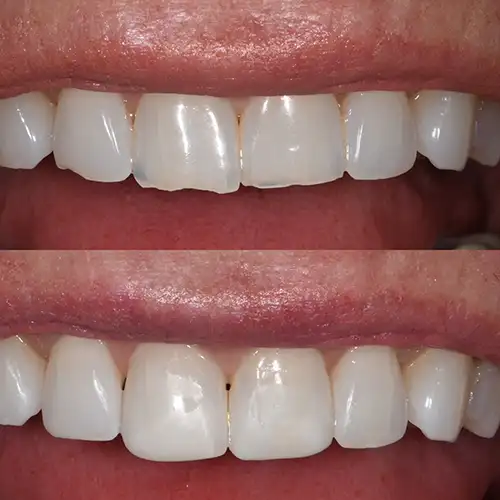 Before & After Gallery image