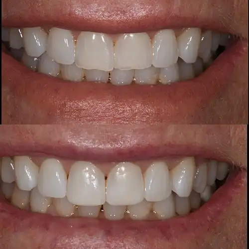 Before & After Gallery image