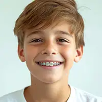 Traditional Metal Braces