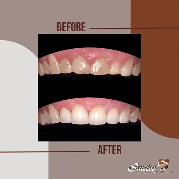 Before and After Image
