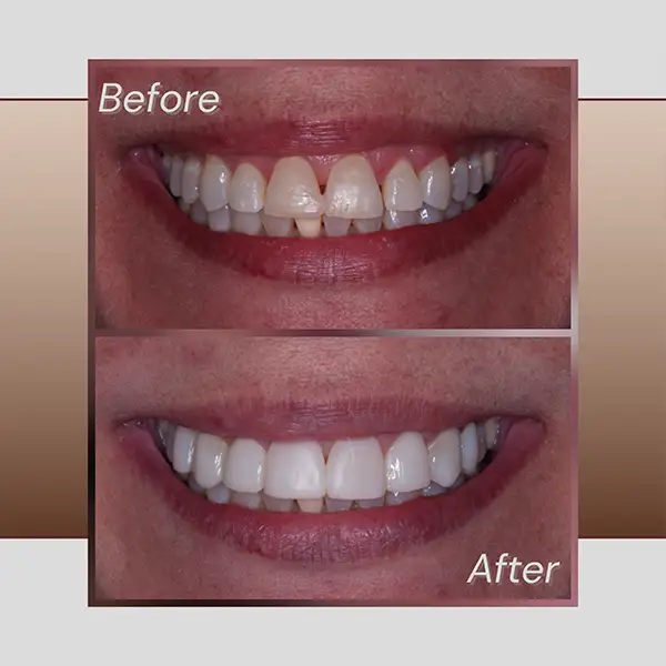 Before and After Image