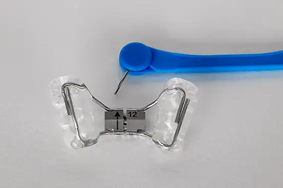 Palatal Expanders