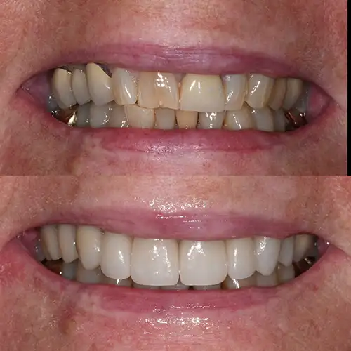 Before & After Gallery image