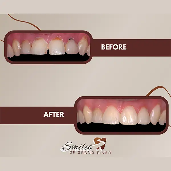 Before and After Image