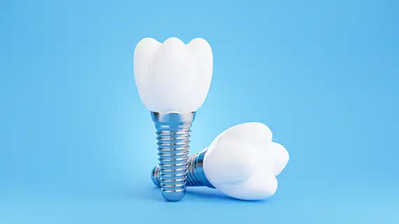 Dental implant