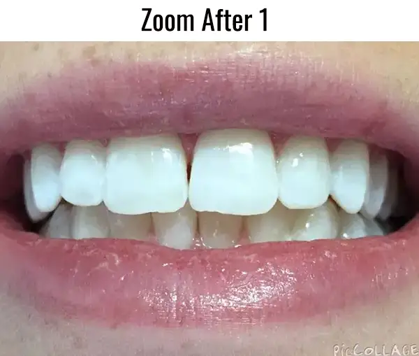 Zoom After 1