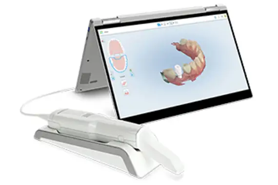 iTero Intraoral Scanner