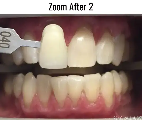 Zoom After 2