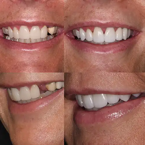 Before & After Gallery image