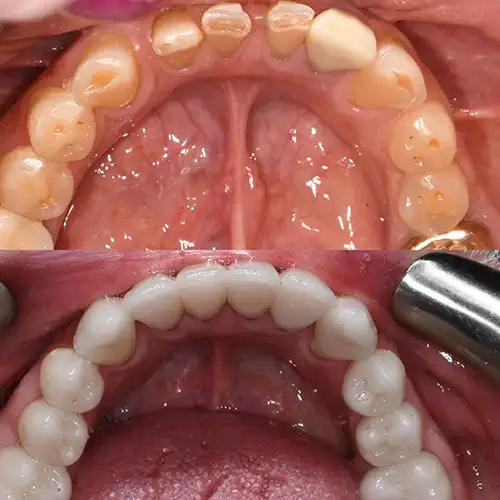 Before & After Gallery image